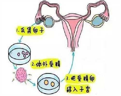 代怀孩子价格与人工授精费用详解